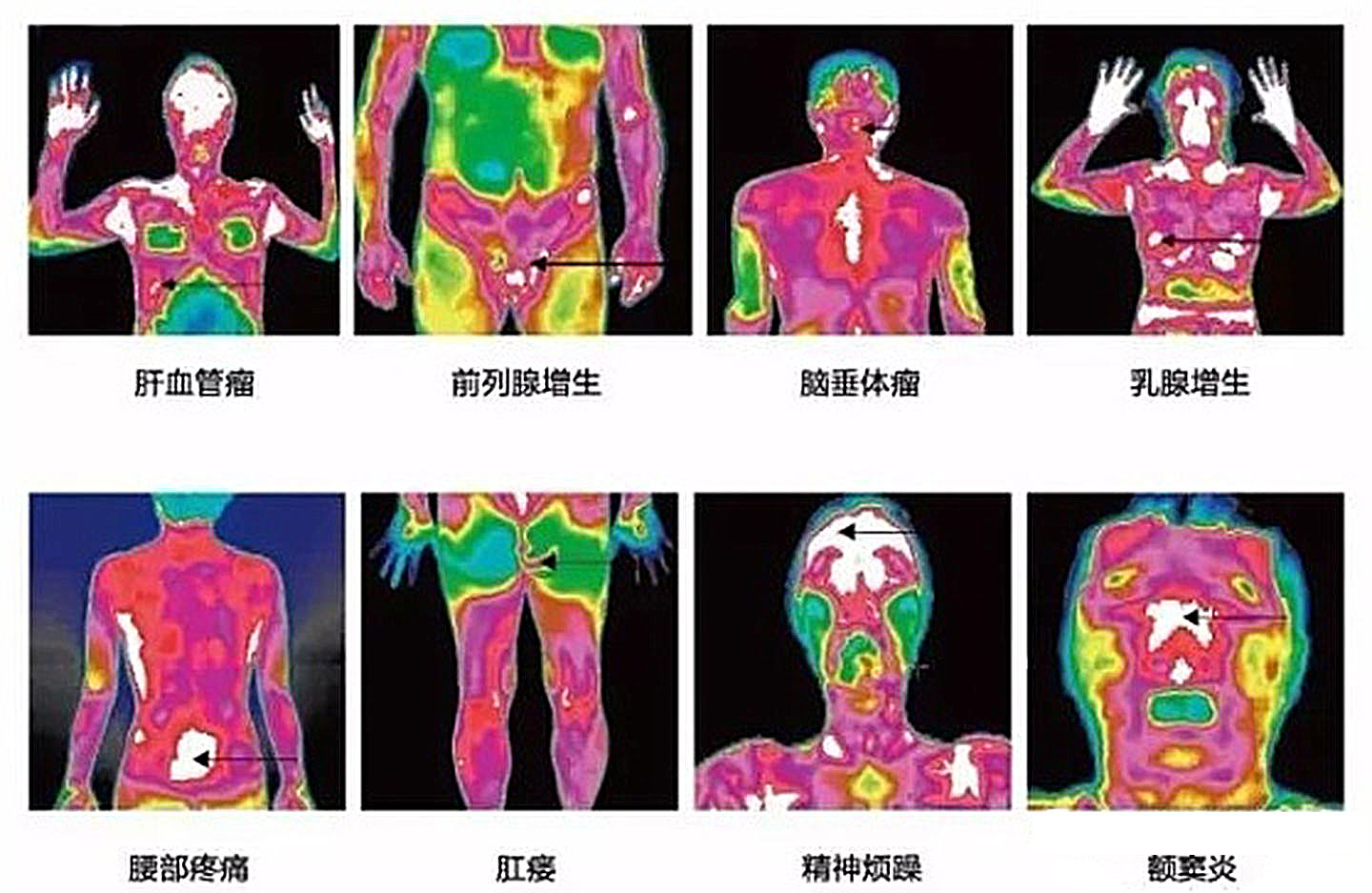 红外热像诊断技术